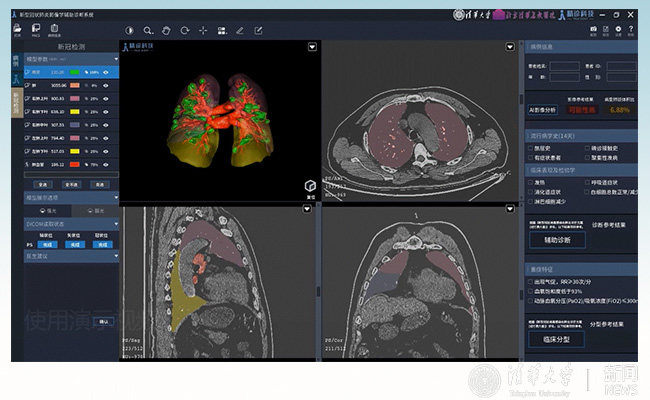 91精品国产自产在线老师啪