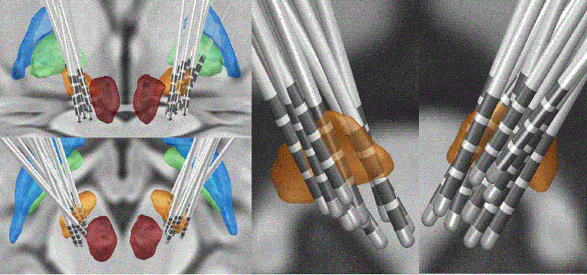 91精品国产自产在线老师啪