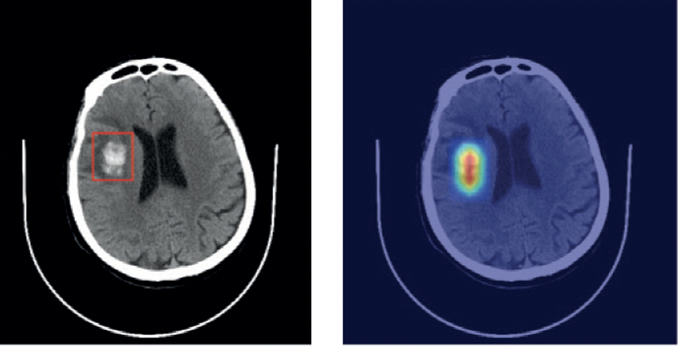91精品国产自产在线老师啪